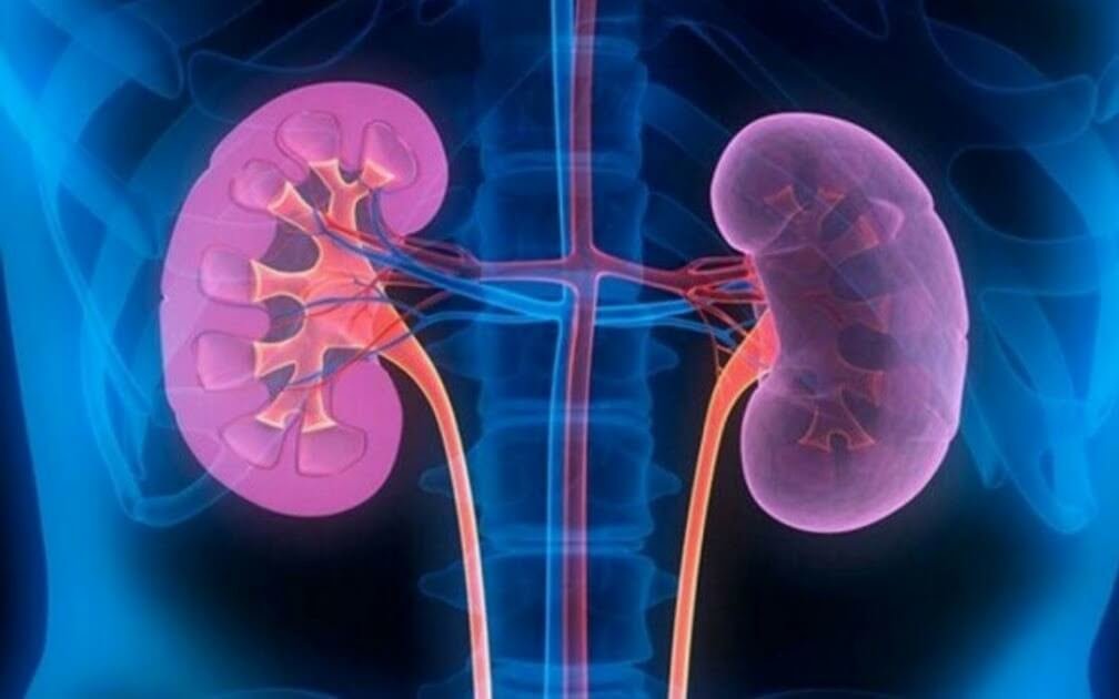 أقوى مشروب لغسيل الكلى ملخص
